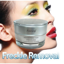 Nueva llegada Fancy Crema para el acné y las pecas a precio mayorista